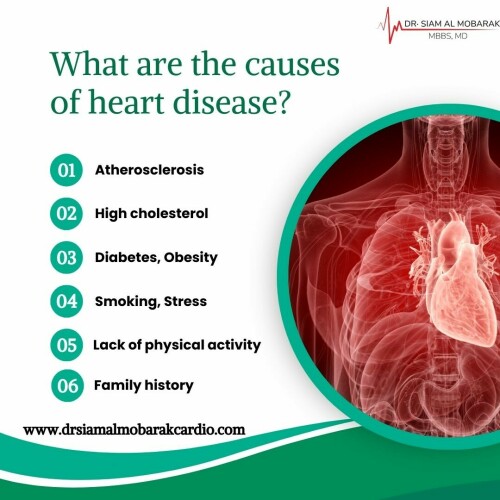 dr-siam--causes-of-heart-disease.jpg