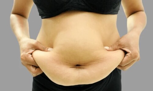 Body-contouring-surgery.jpg